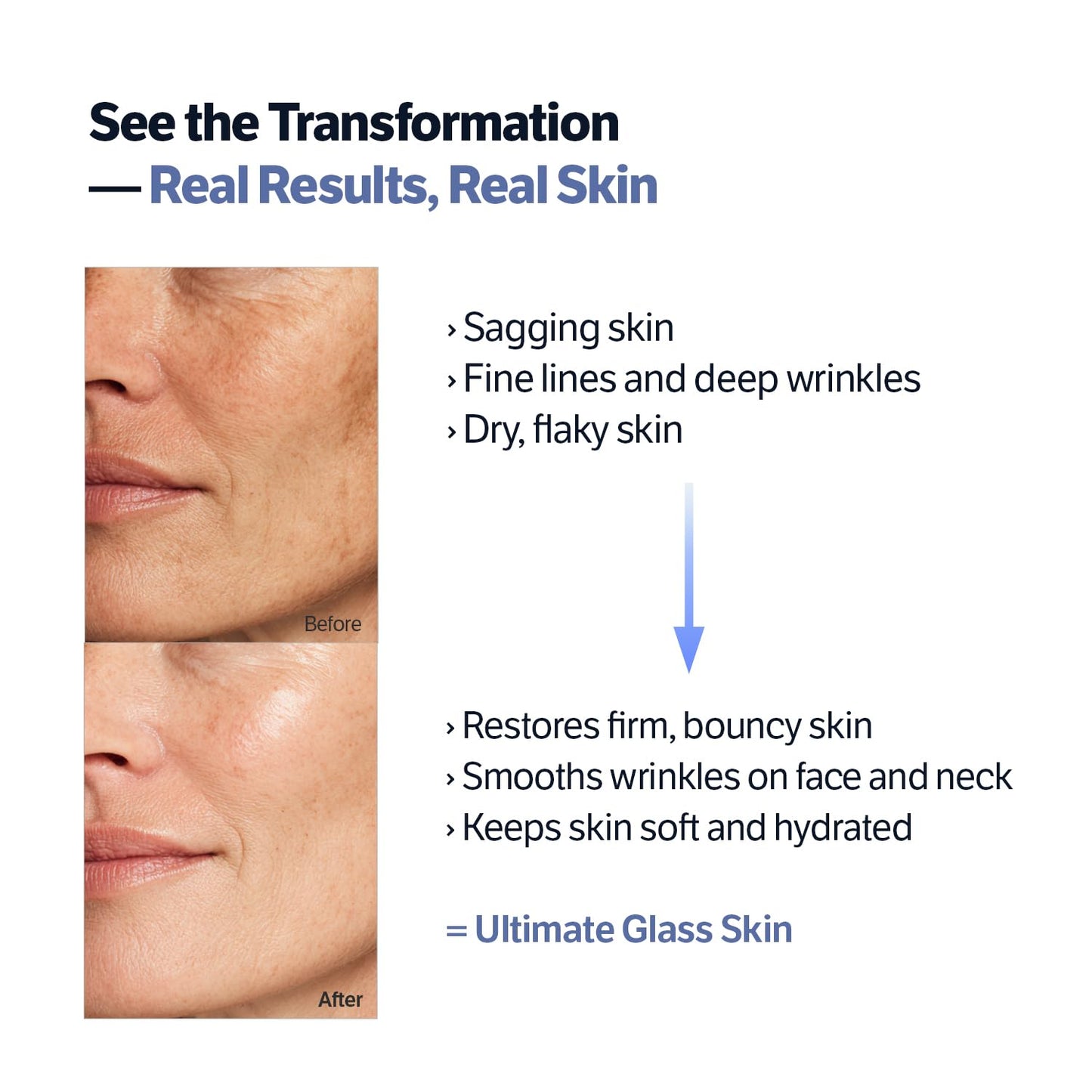 SUNGBOON EDITOR Deep Collagen Retinol Power Boosting Capsule Face & Neck Cream | Microneedling, White Spicules, Skin Firming, Hydration for Dry Skin, Wrinkles, Face Moisturizer, 1.69 fl.oz Alura